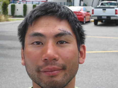 Stiches closeup